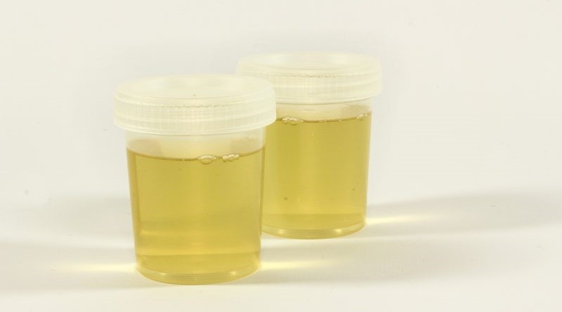Synthetic Urine Heating Pad Tarrytown NY 10592